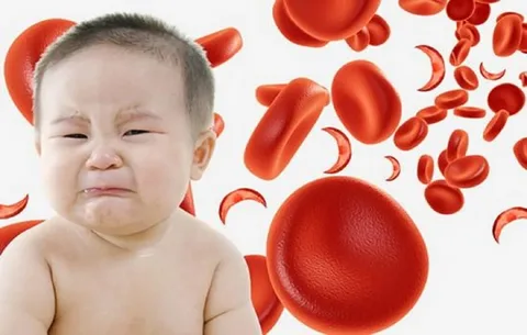 فقر الدم عند الرضع أسبابه وعلاجه
