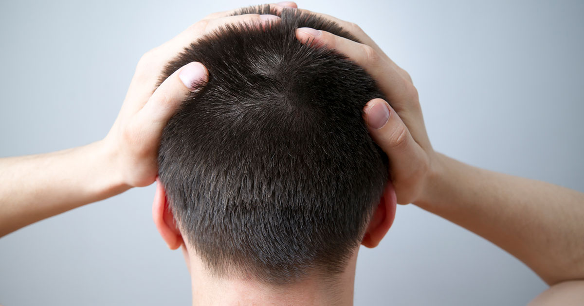 علاج ألم فروة الرأس وتساقط الشعر