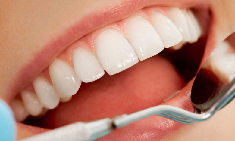 تعرف على زراعة الأسنان الامامية وفوائدها