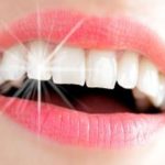 زراعة الأسنان الامامية