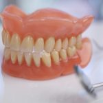 زراعة الأسنان بالأطقم القابلة للإزالة