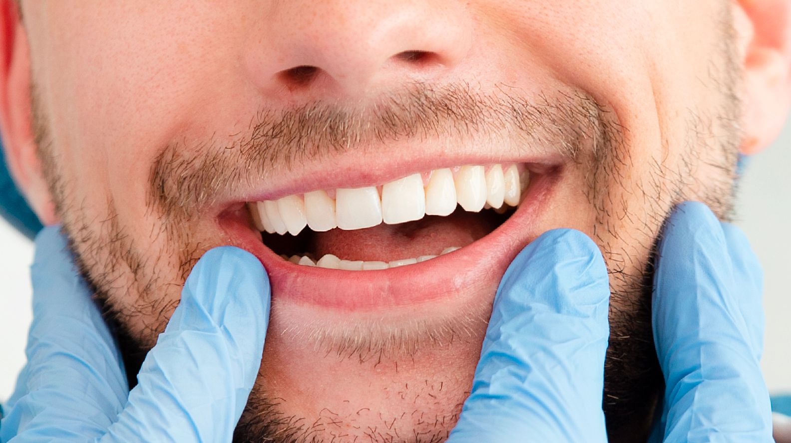 زراعة الاسنان بدون جراحة