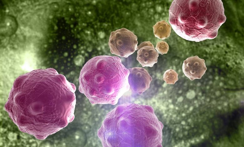 علاج مرض سرطان باركنسون بالخلايا الجذعية : الواقع والآفاق