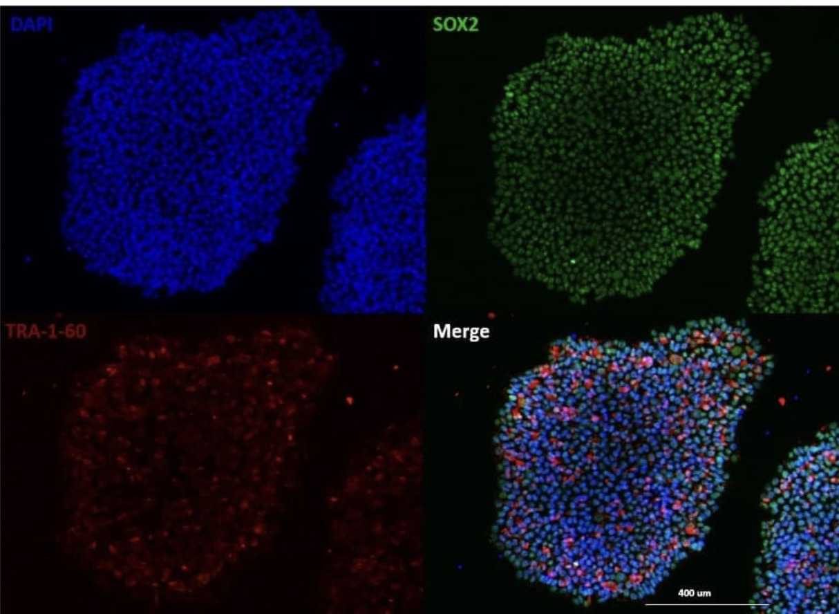 الخلايا الجذعية المحفزة 